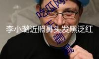 李小璐近照鼻頭發(fā)黑泛紅，43歲了還在尋求少女感，完全變成幼態(tài)臉